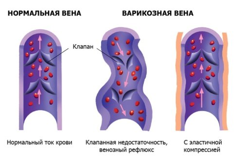 veins.jpg